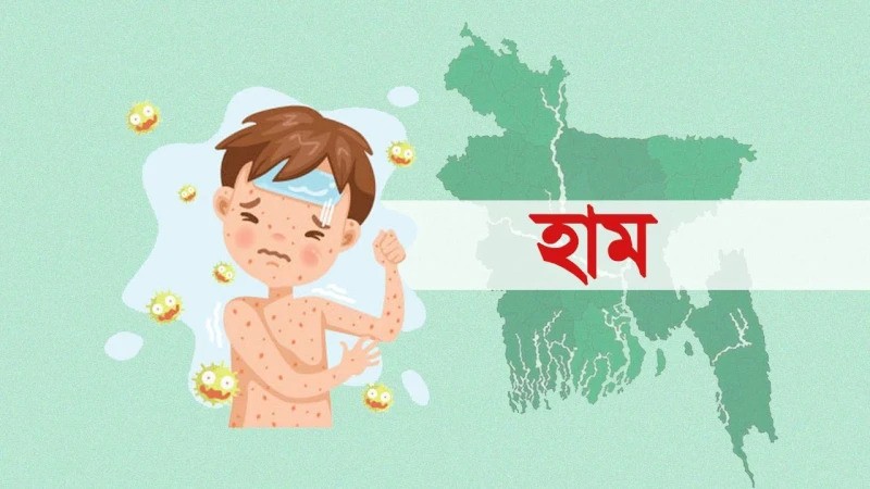 ২৪ ঘণ্টায় হাম ও উপসর্গে ১১ মৃত্যু,
